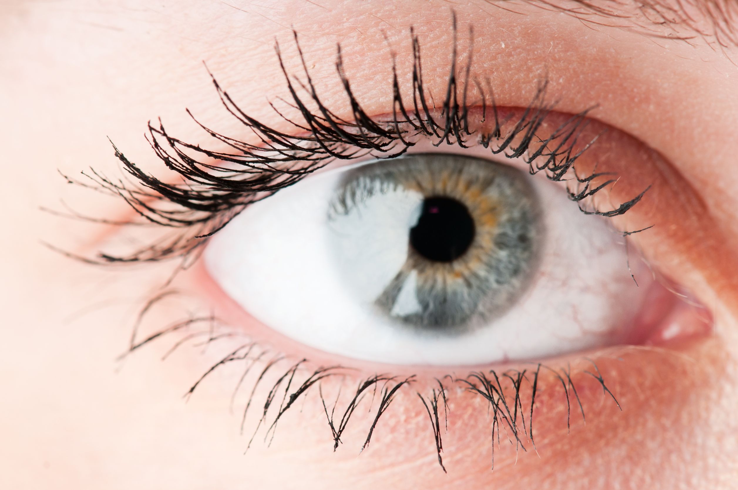 Understanding Eye Styes Cause Symptoms And Treatment Options Easy Articles 