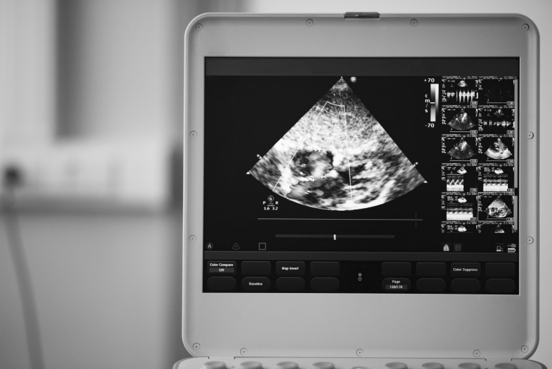 Things to Consider When Looking for An Ultrasound Equipment for Sale