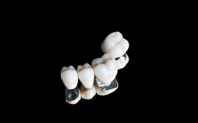 Tips for Taking Care of Dental Crowns in Parkland, FL