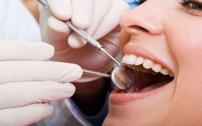 Explore Top Benefits of Dental Crowns in Fort Myers FL